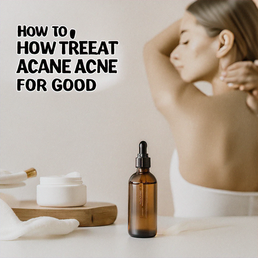 How to Treat Bacne (Back Acne) for Good